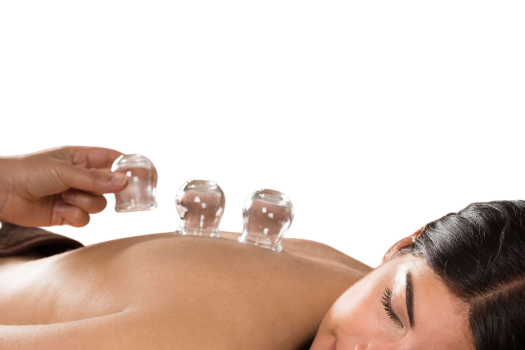 Cupping Therapy For Weight Loss